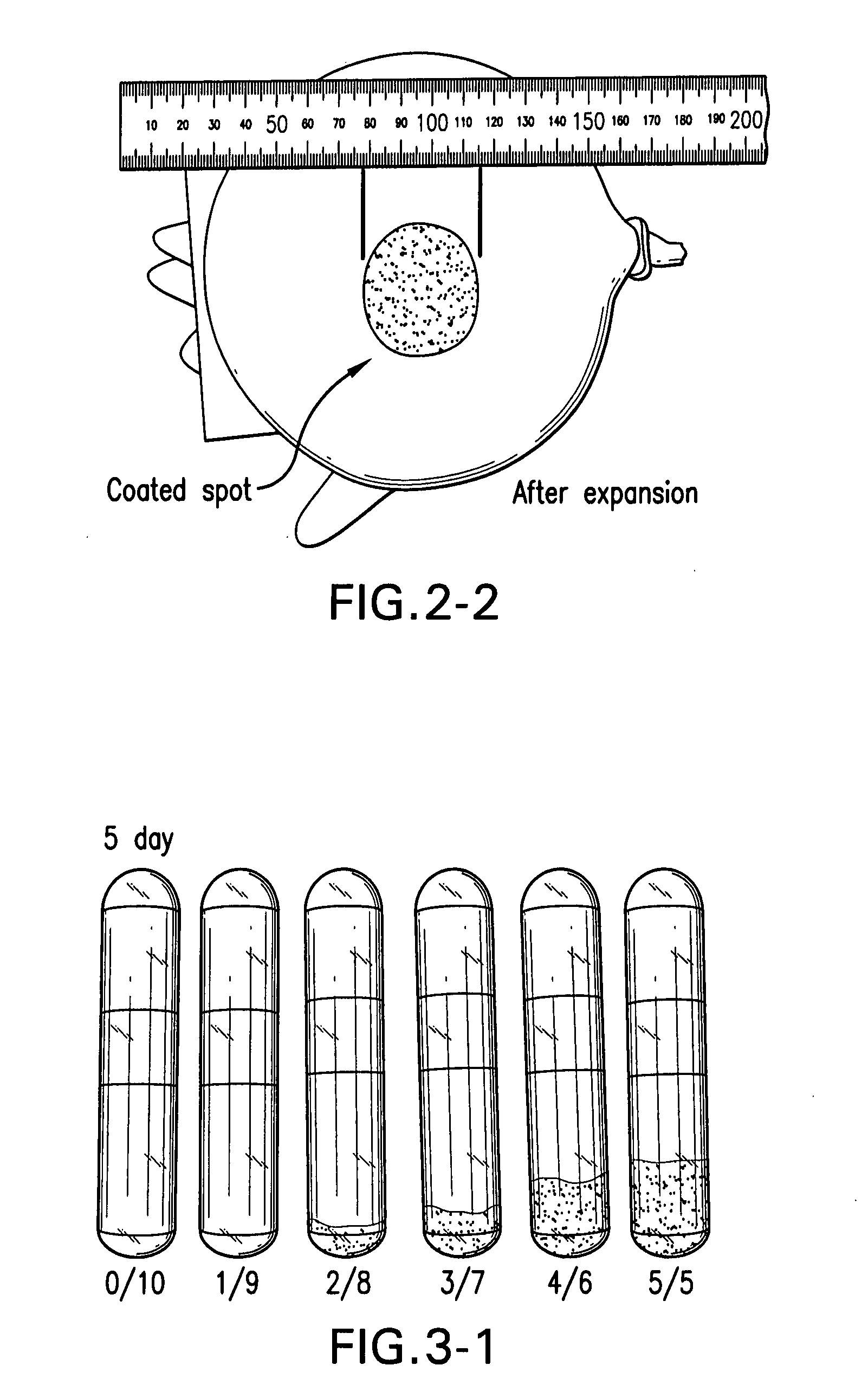 Medical-use two part reactive adhesive and medical-use resin having self-degradation property