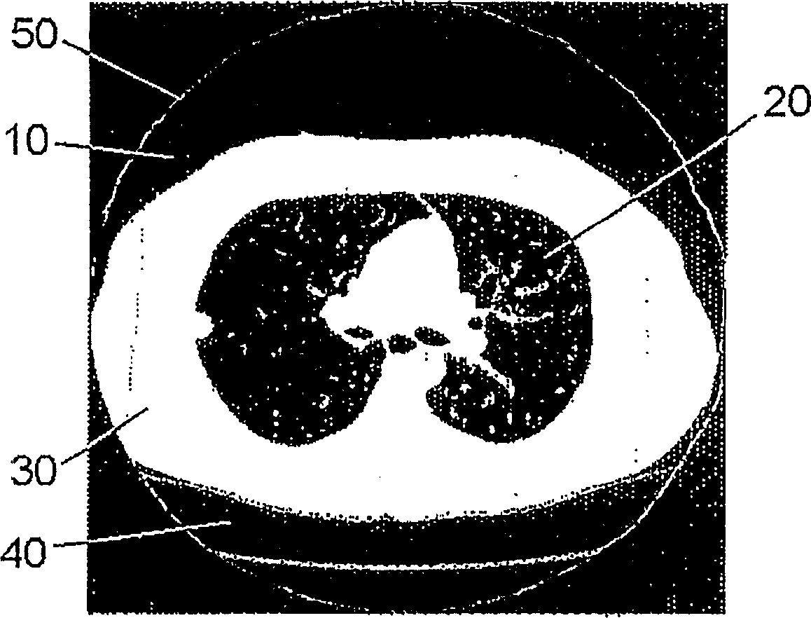 Method and device for forming an isolated visualization of body structures