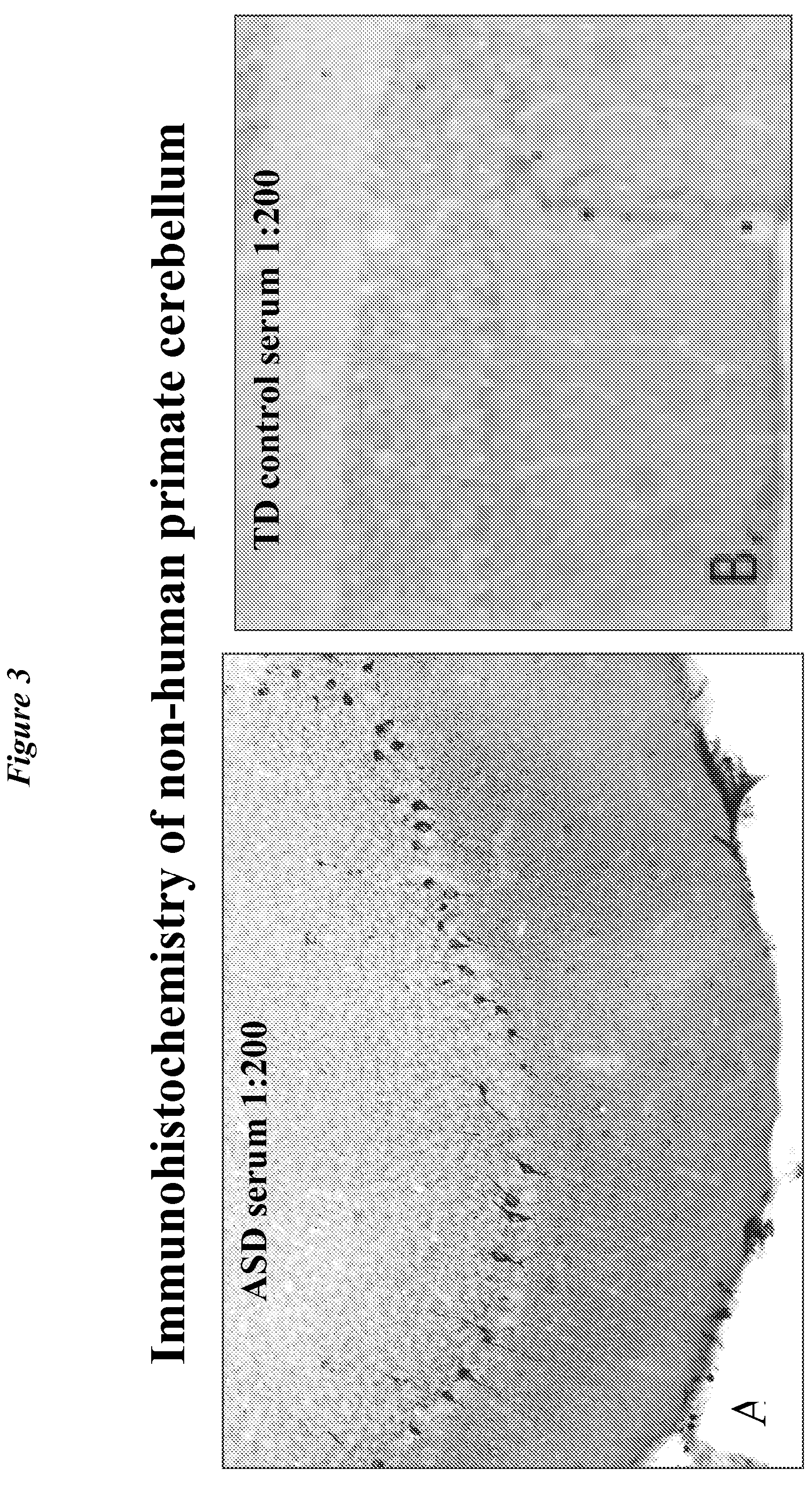 Diagnostic methods for the detection of autism spectrum disorder