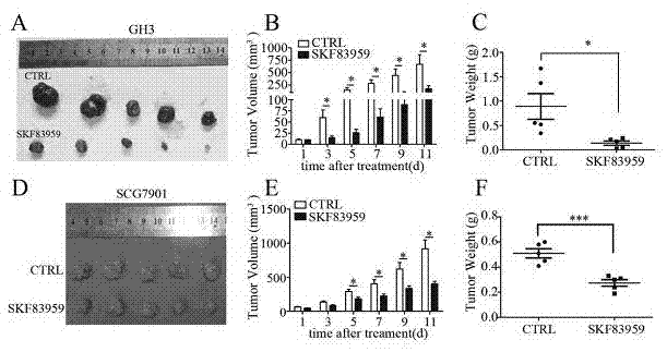 Applications of dopamine I receptor agonists in preparing tumor treatment medicines