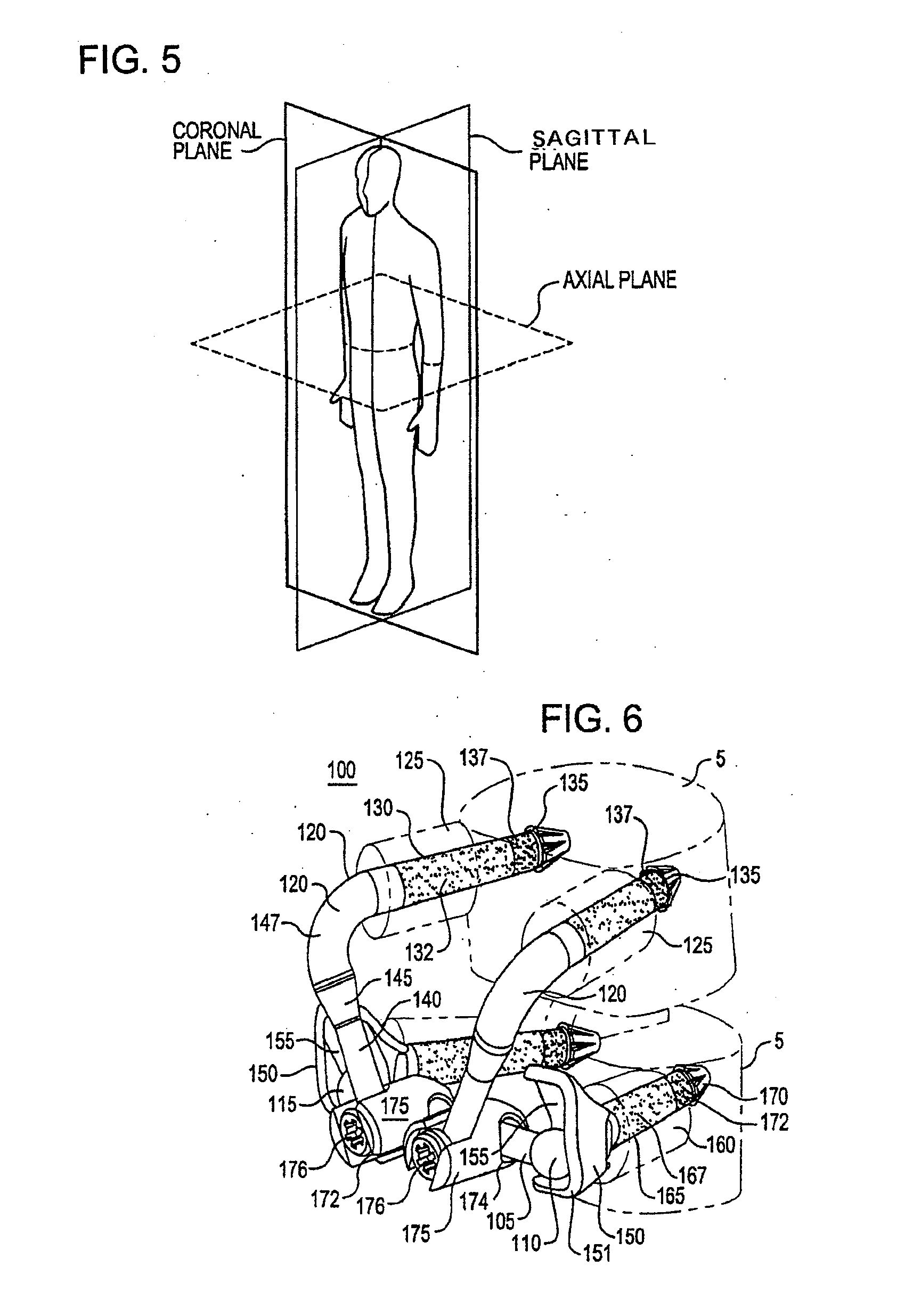 Crossbar spinal prosthesis having a modular design and systems for treating spinal pathologies