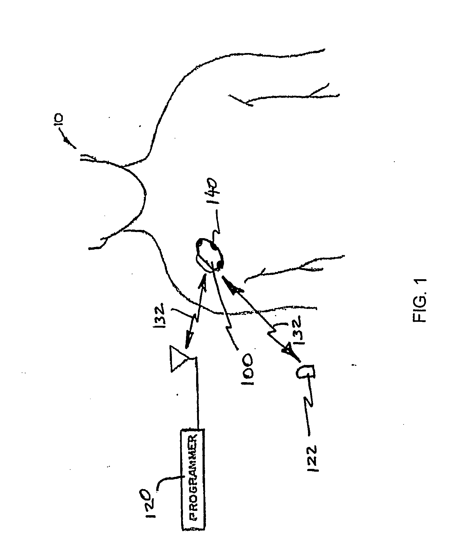 Techniques for selective channel processing and data retention in an implantable medical device