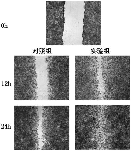 Application of porphyra haitanensis polysaccharide in invigorating stomach and preventing or repairing gastrointestinal injury