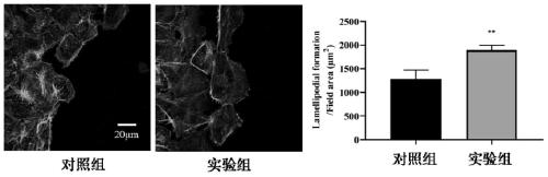 Application of porphyra haitanensis polysaccharide in invigorating stomach and preventing or repairing gastrointestinal injury