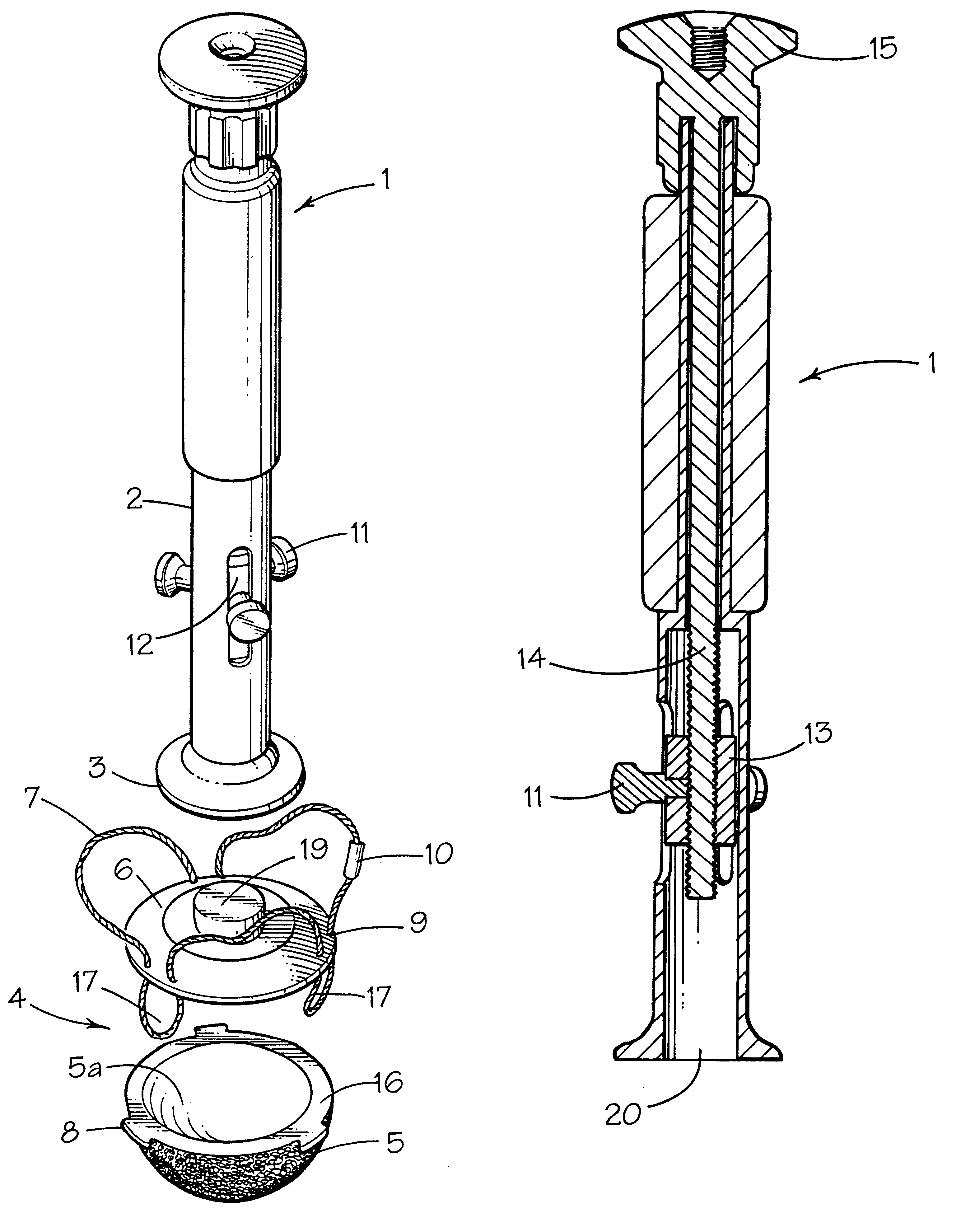 Prosthetic implant and surgical tool