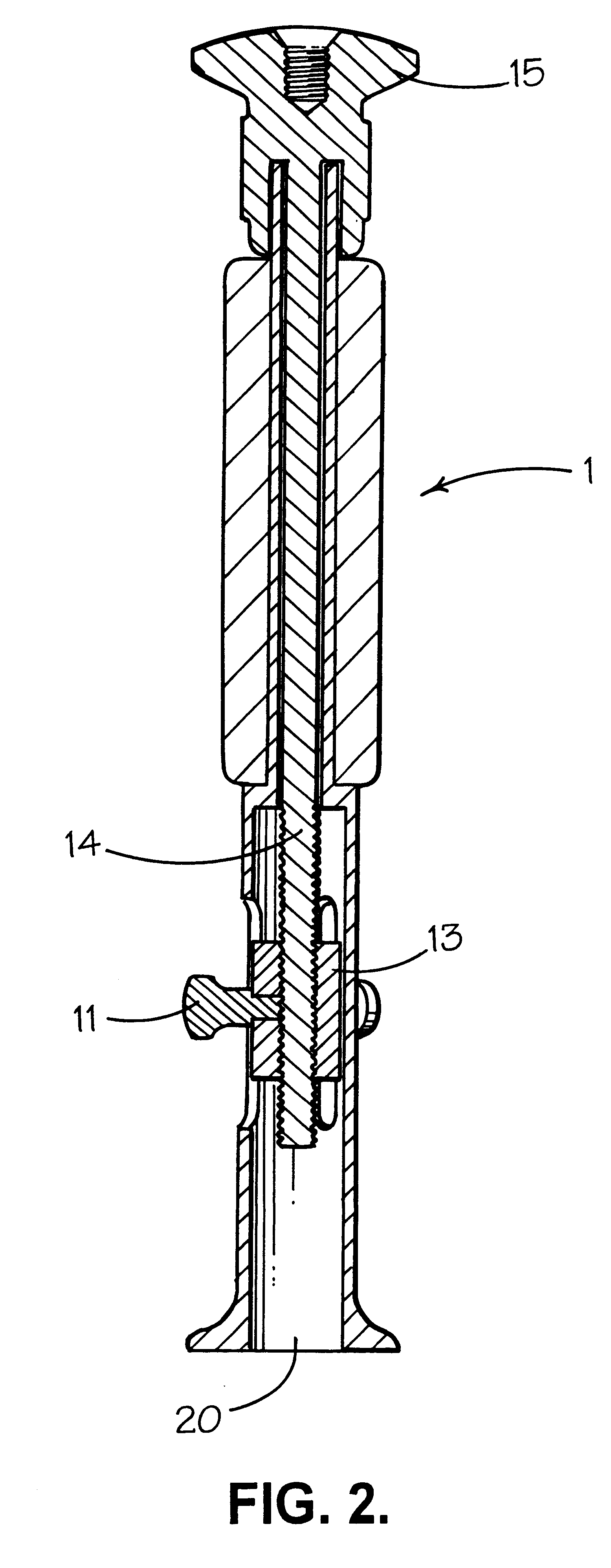 Prosthetic implant and surgical tool