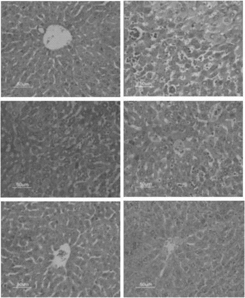 Use of lachnum intracellular melanin serving as acute liver injury medicine