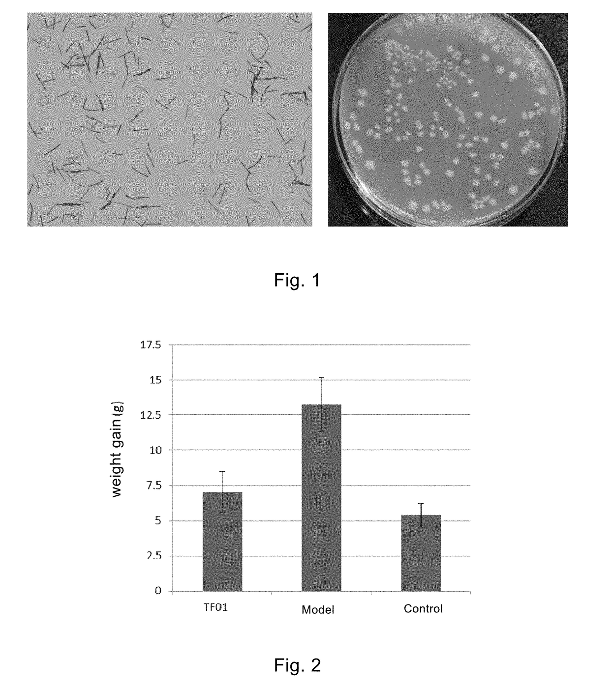 Intestinal bacteria butyribacterintestini and application thereof