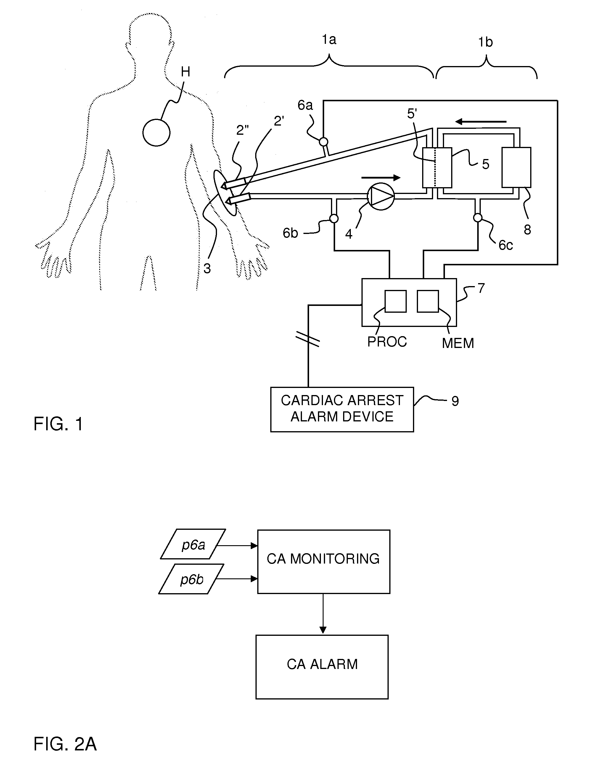 Monitoring of cardiac arrest in a patient connected to an extracorporeal blood processing apparatus