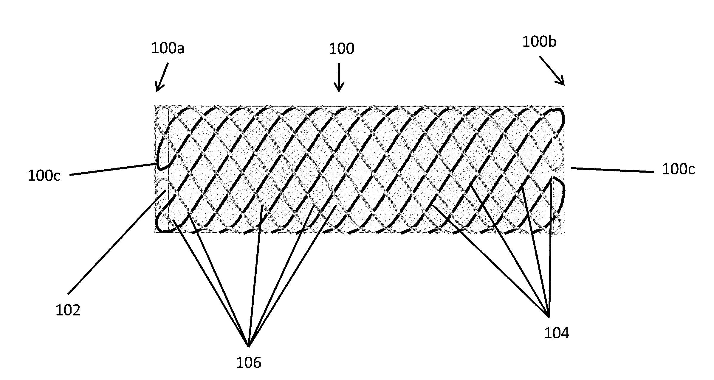 Braided helical wire stent