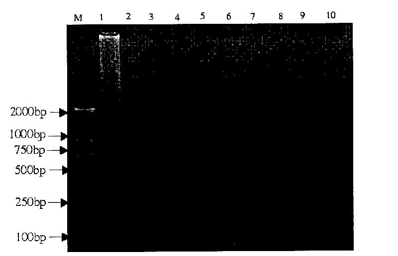 Primer group for detecting vibrio coralliilyticus by using LAMP, quick diagnosis kit and detecting method