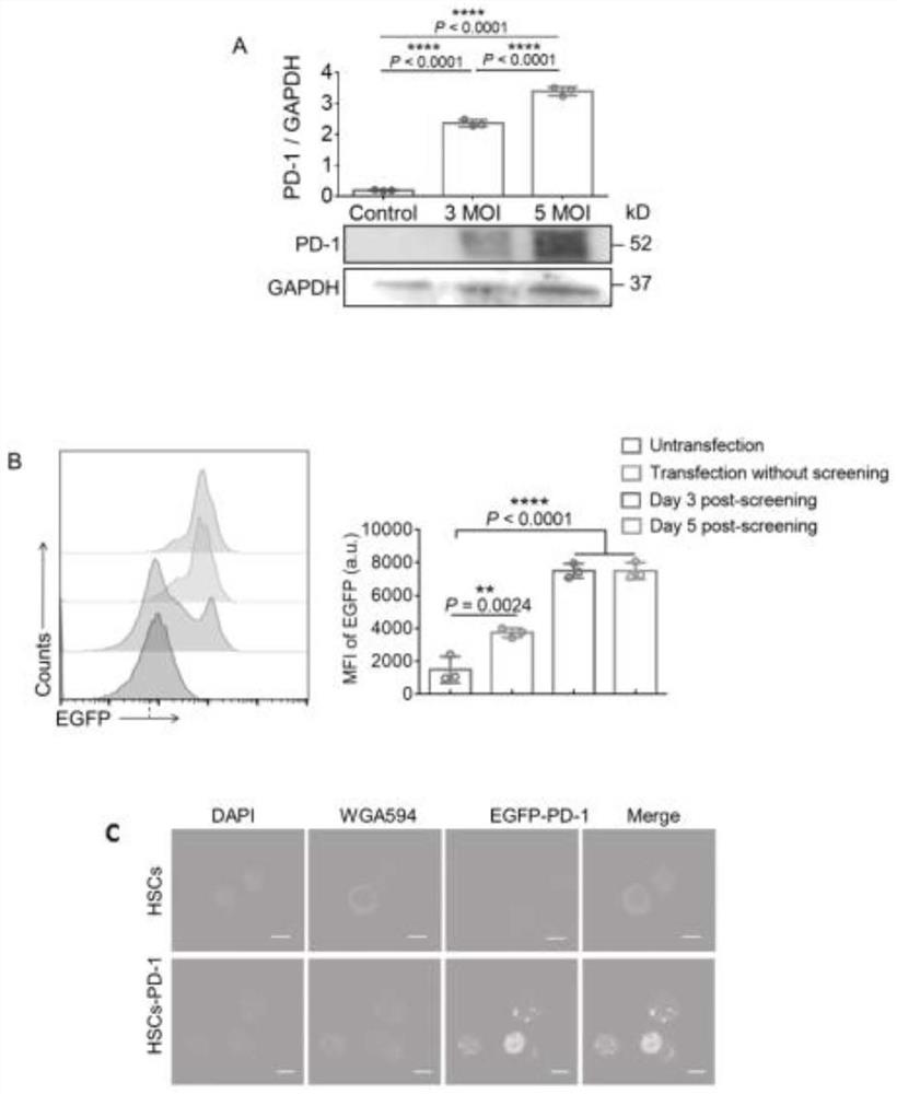 Genetically engineered hematopoietic stem cell drug delivery system as well as preparation method and application thereof