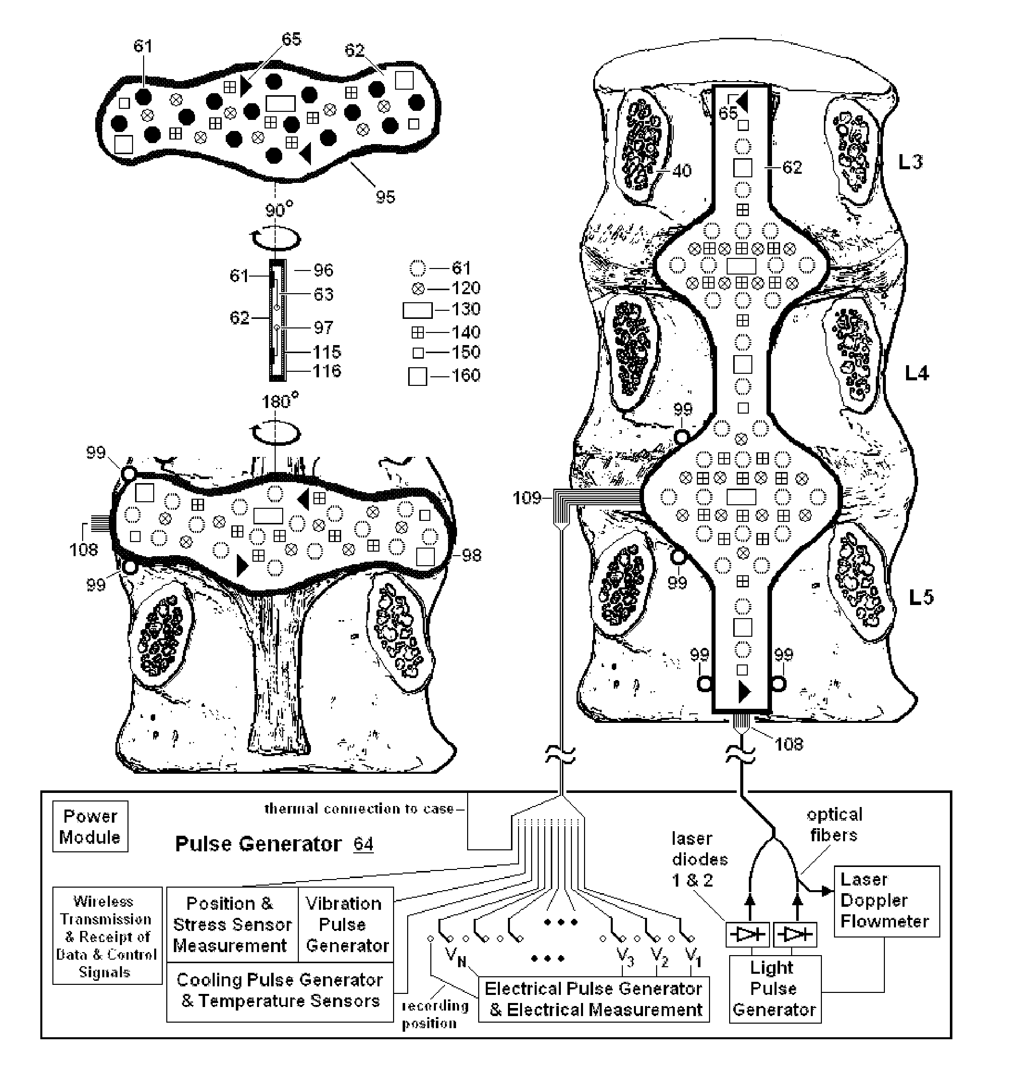 System and Methods for Diagnosis and Treatment of Discogenic Lower Back Pain