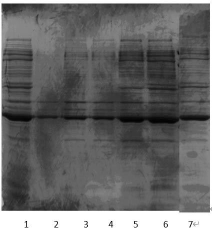 Purification and preparation process of recombinant staphylokinase mutant