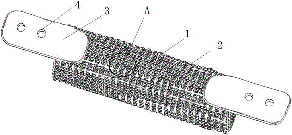 Bone repair support with self-repairing and anti-bacterial functions and manufacturing method of bone repair support