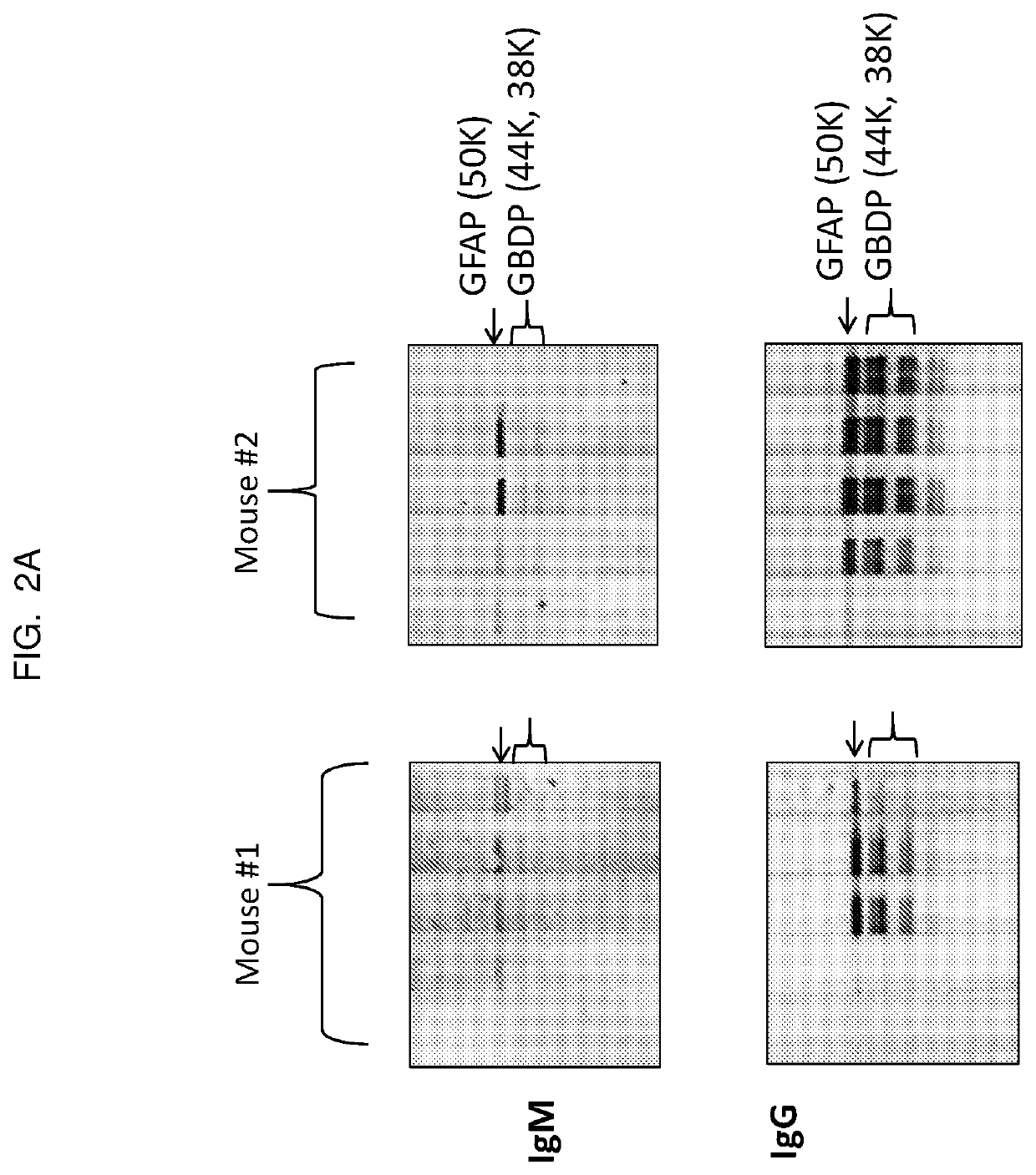 Glial fibrillary acidic protein targeting immuno- and aptamer-based-therapy for neuroinjury, neurodegeneration, neuro-disease, and neuro-repair