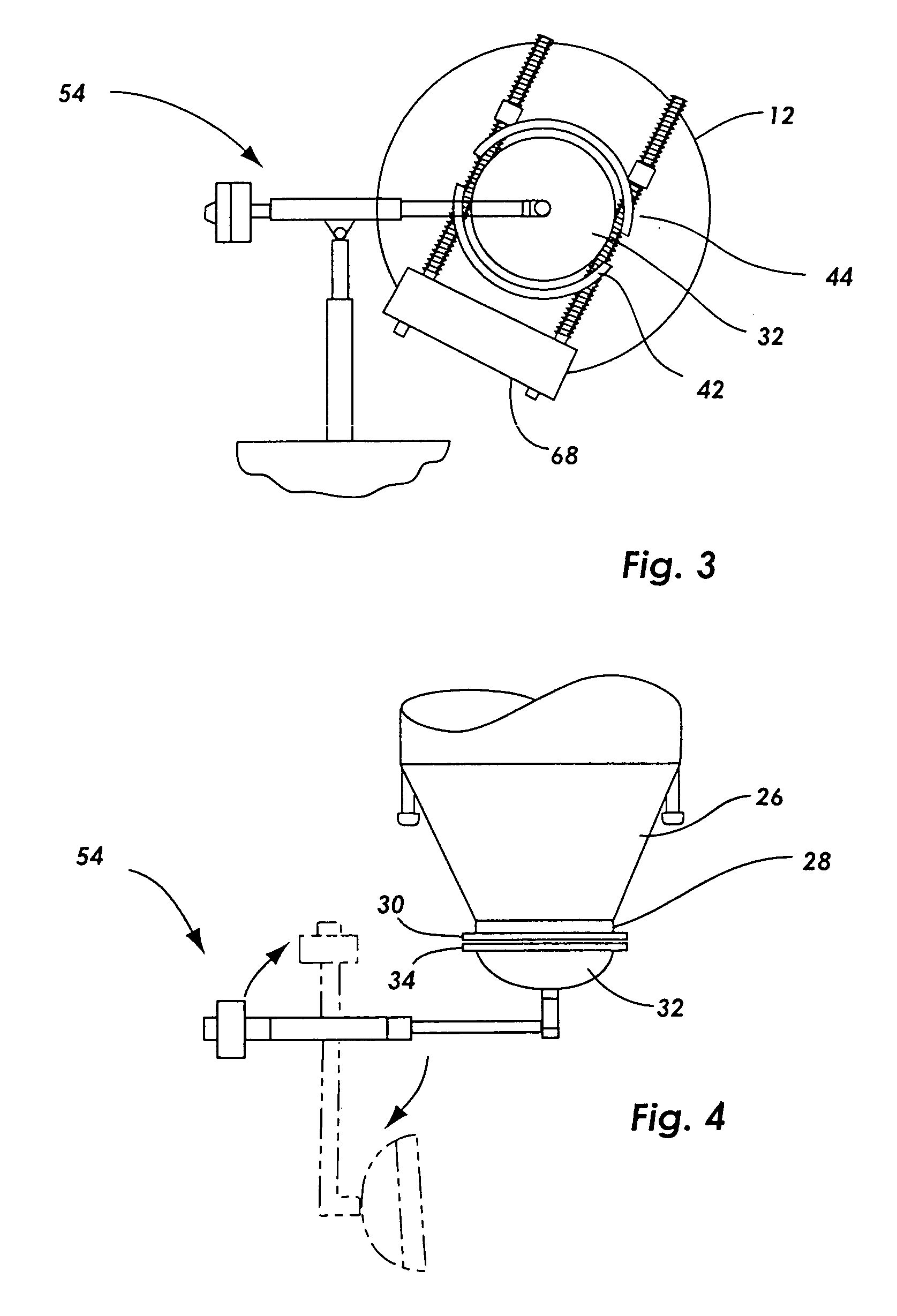 MSW processing vessel