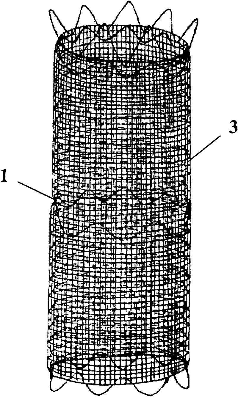 Compound netty stent