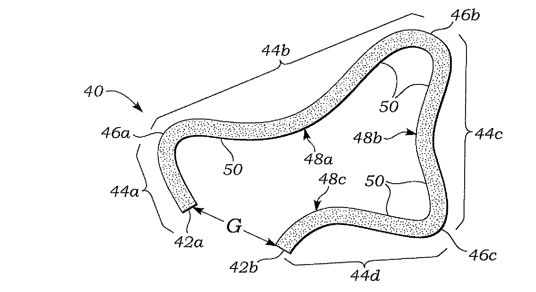 Inwardly-bowed tricuspid annuloplasty ring