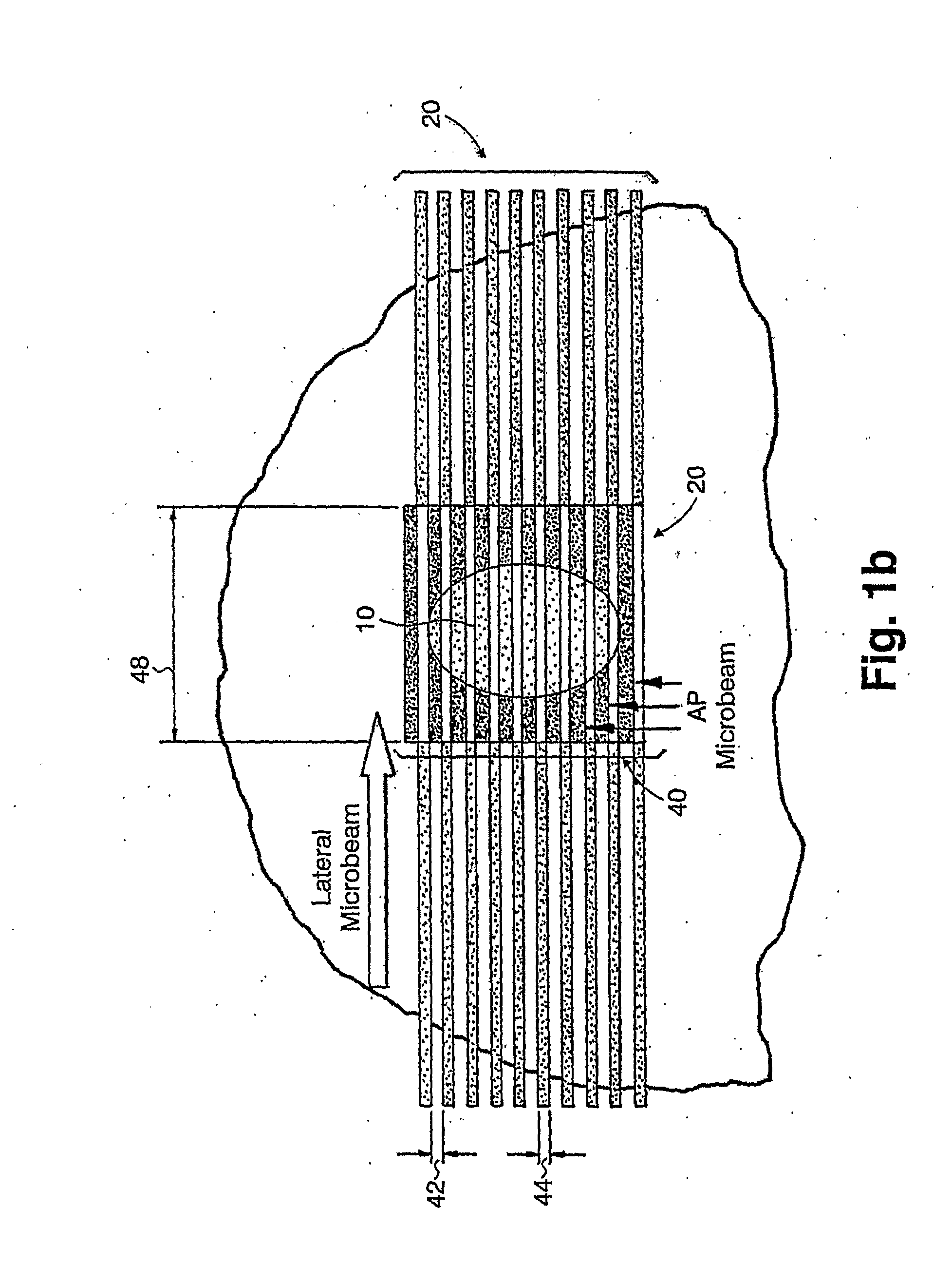 Methods for Implementing Microbeam Radiation Therapy