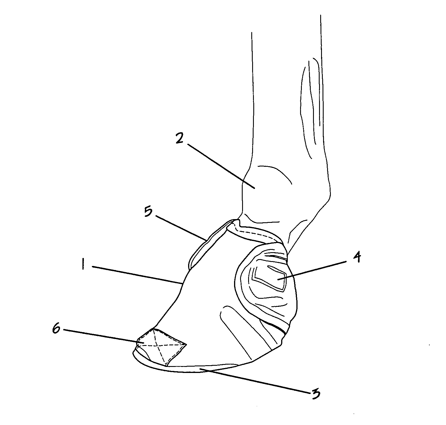 Therapeutic equine hoof sock