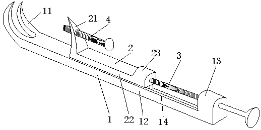 Femoral lesser trochanter fracture reduction and fixation guider