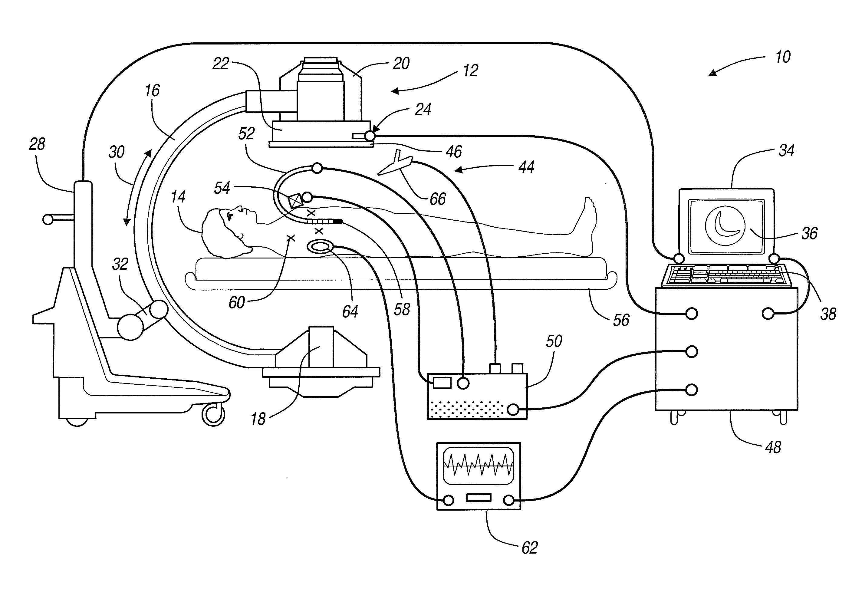 Navigation System for Cardiac Therapies