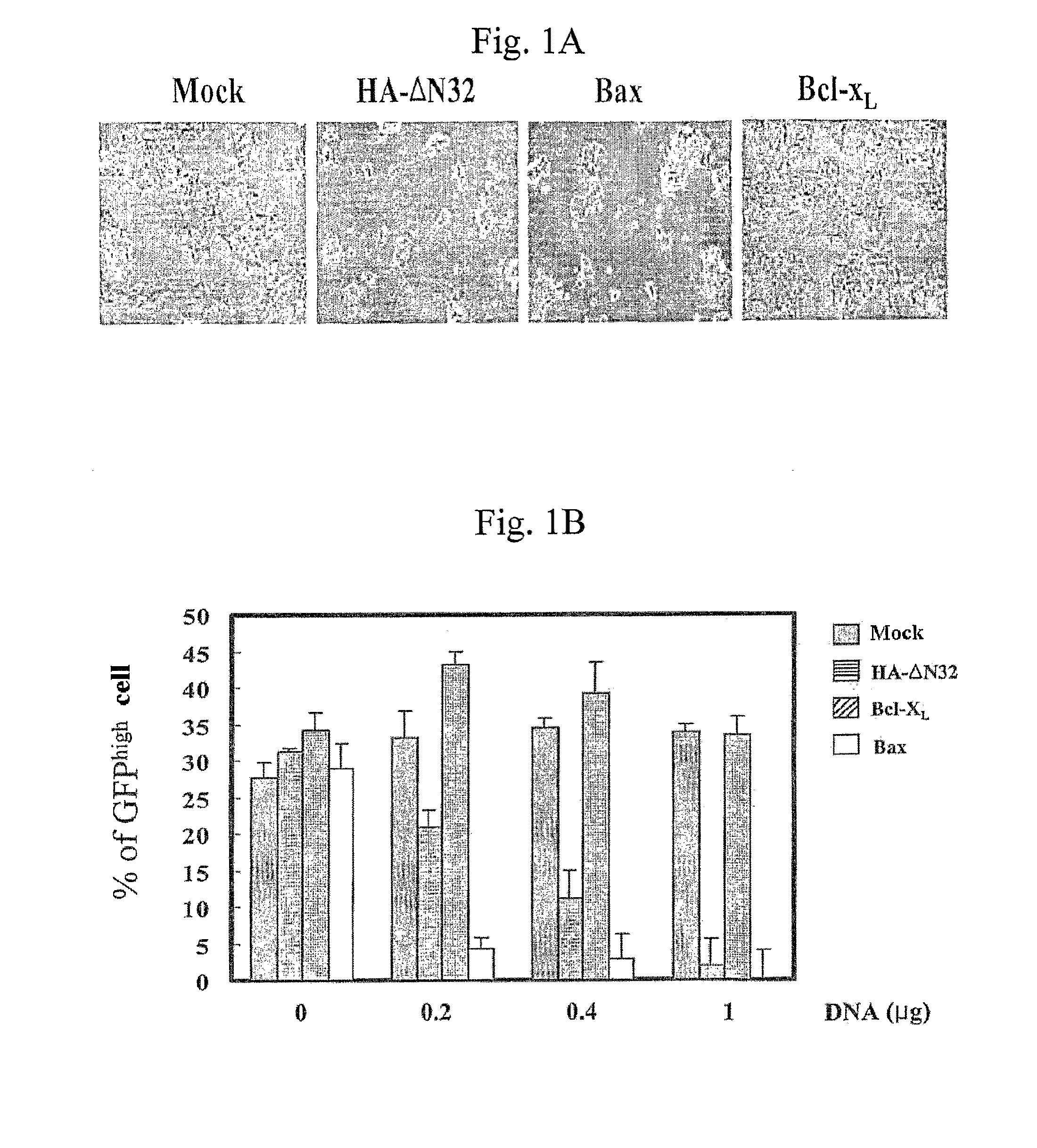 Recombinant Adenovirus Expressing A Gene Encoding Streptolysin O Proetin and Anti-Cancer Composition Comprising Same