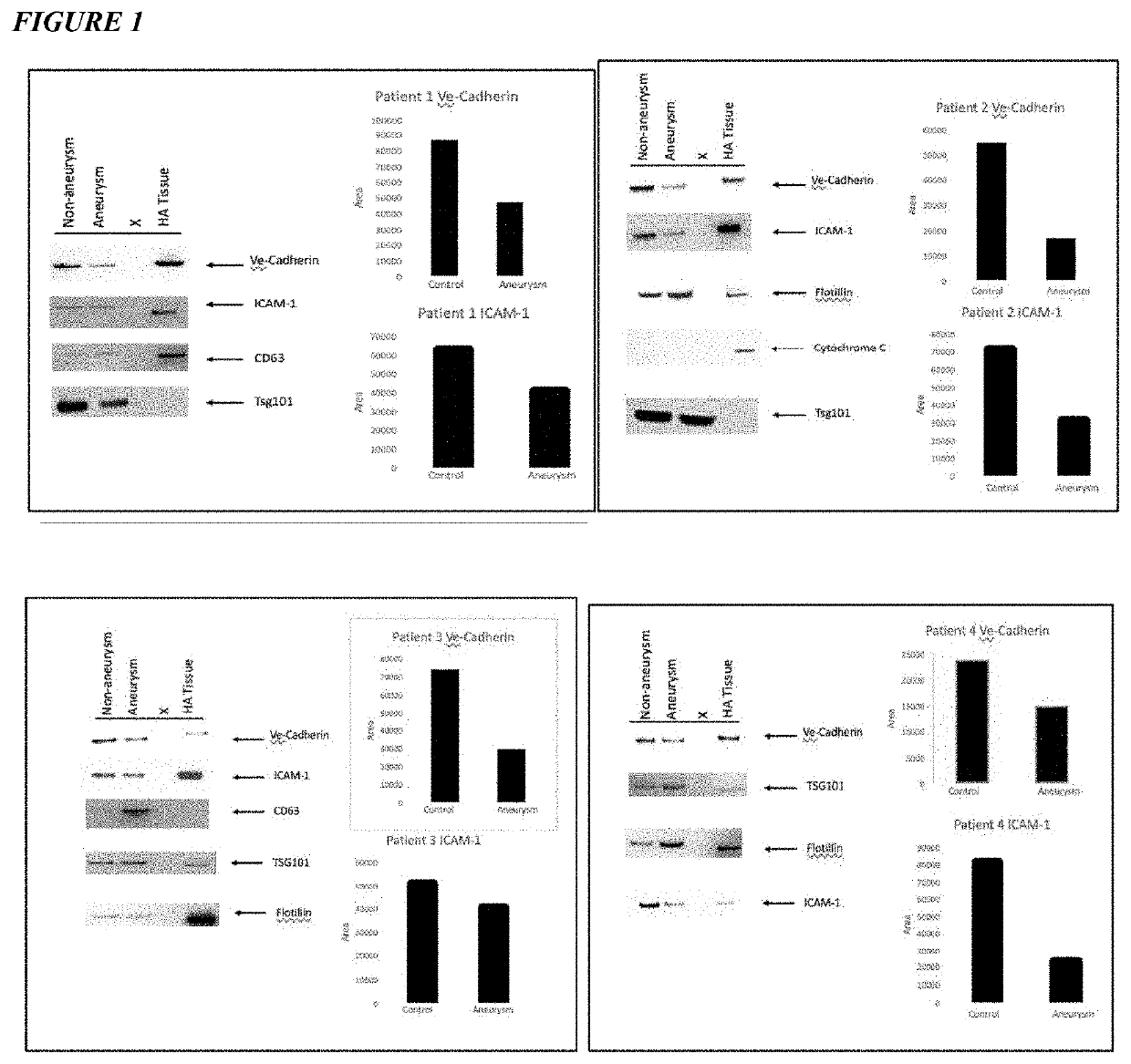 Methods for treating aortic aneurysm disease