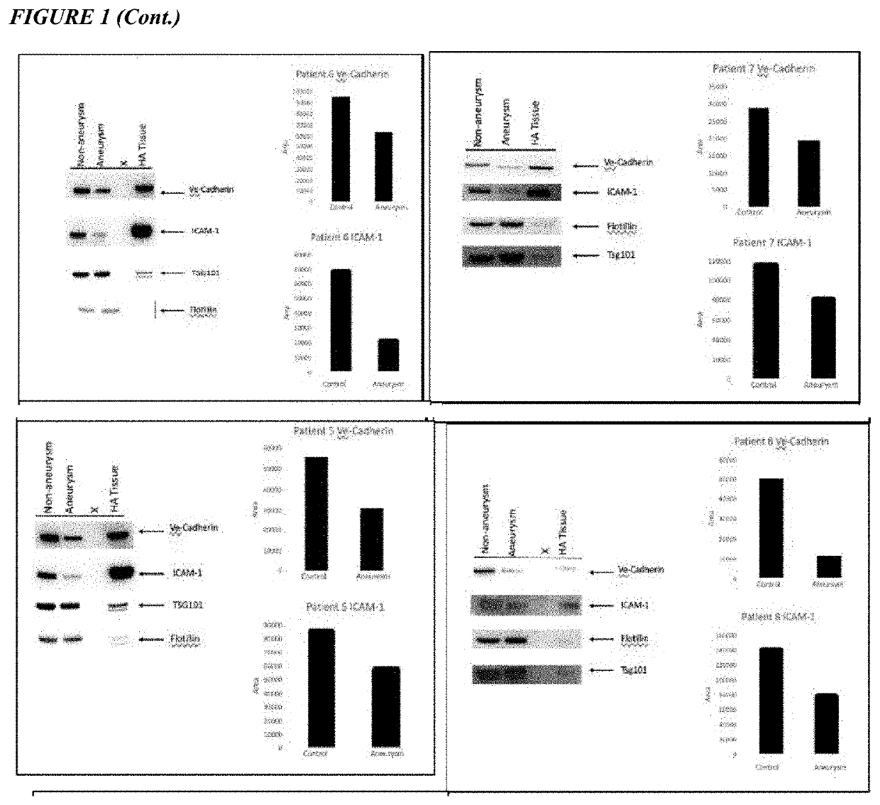 Methods for treating aortic aneurysm disease