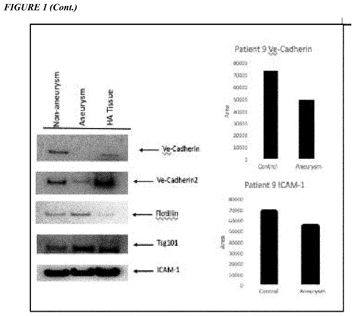 Methods for treating aortic aneurysm disease