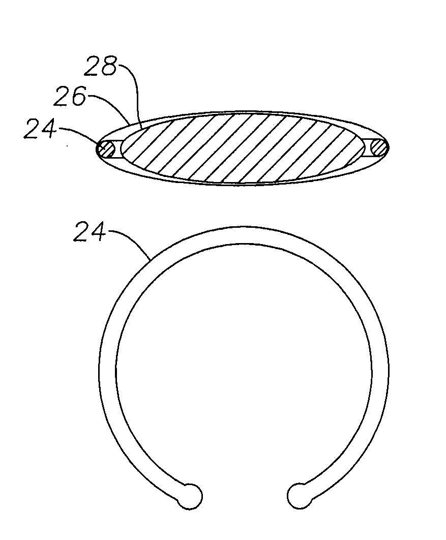 Ophthalmic device having therapeutic agent delivery capability and method of forming same