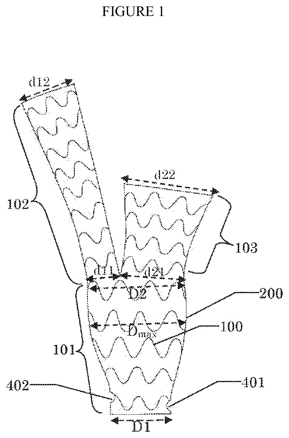 Ascending aortic stent graft