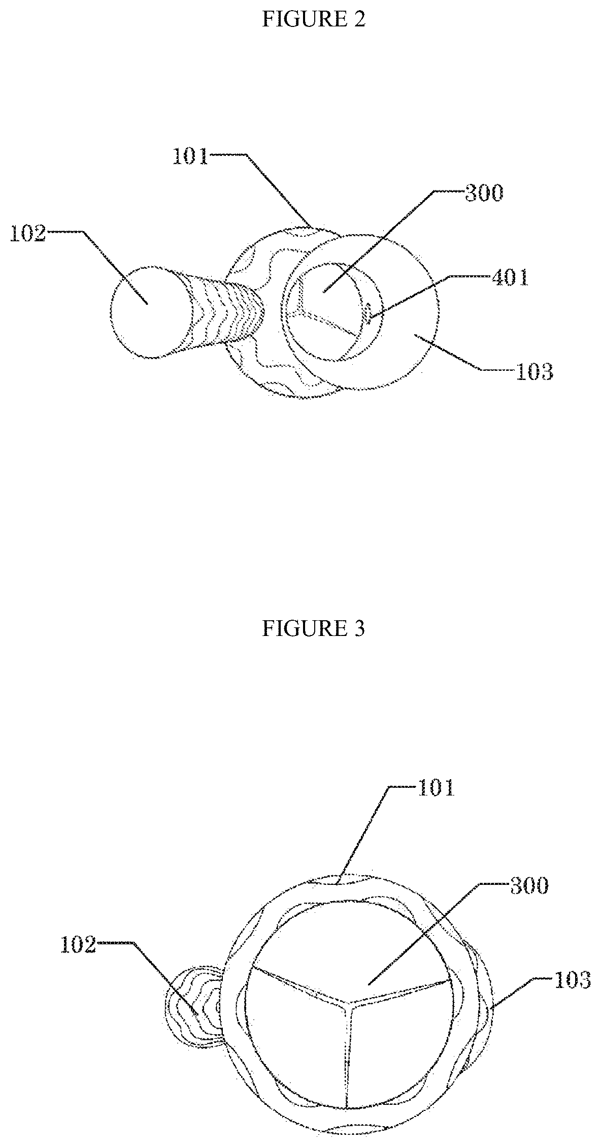 Ascending aortic stent graft