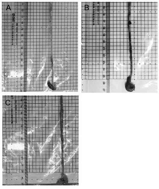 Application of piceatannol-3'-O-beta-D-glucopyranoside in treatment of small intestine ischemia/reperfusion injury