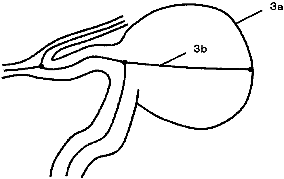 Blood vessel image processing apparatus, blood vessel image processing program, and blood vessel image processing method