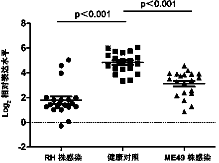 Identified mmu-miR-217-5p capable of detecting toxoplasma gondii infection