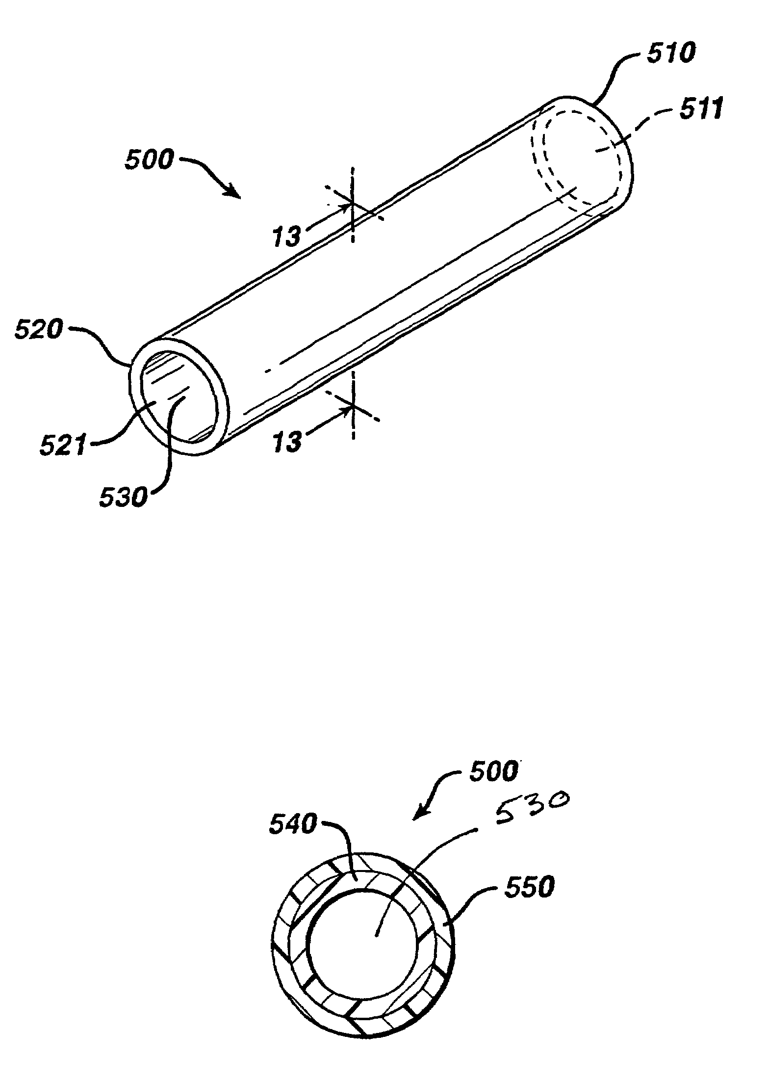 Biodegradable stent