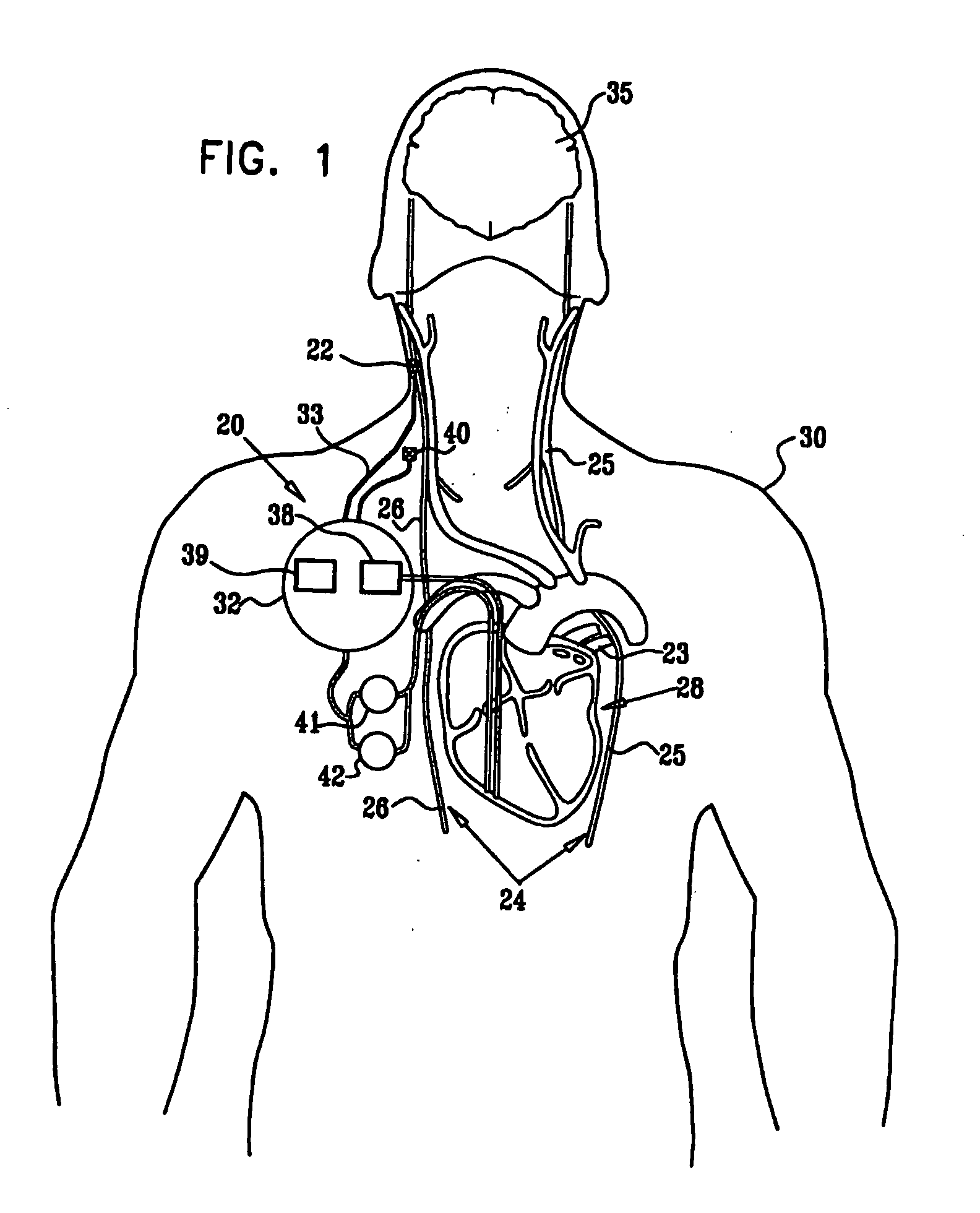 Combined parasympathetic stimulation and drug therapy