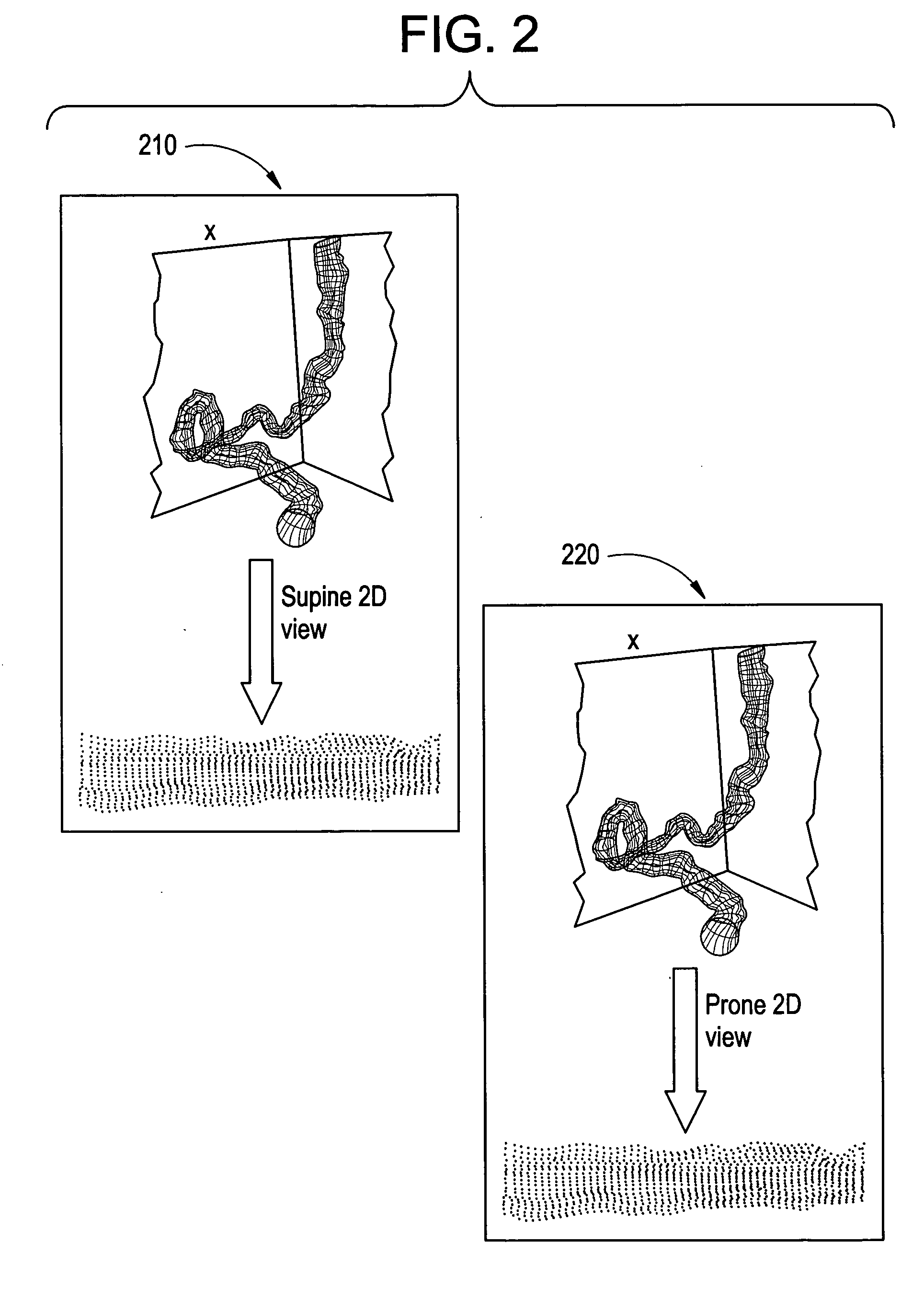 Method and apparatus for synchronizing corresponding landmarks among a plurality of images