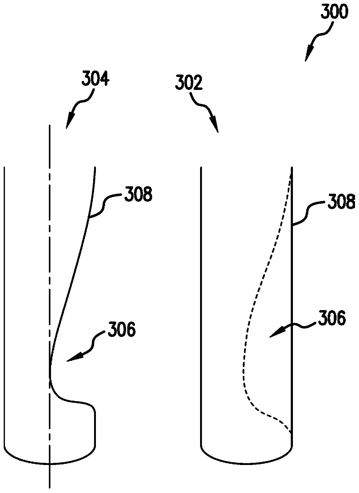 Personalized coronary stents