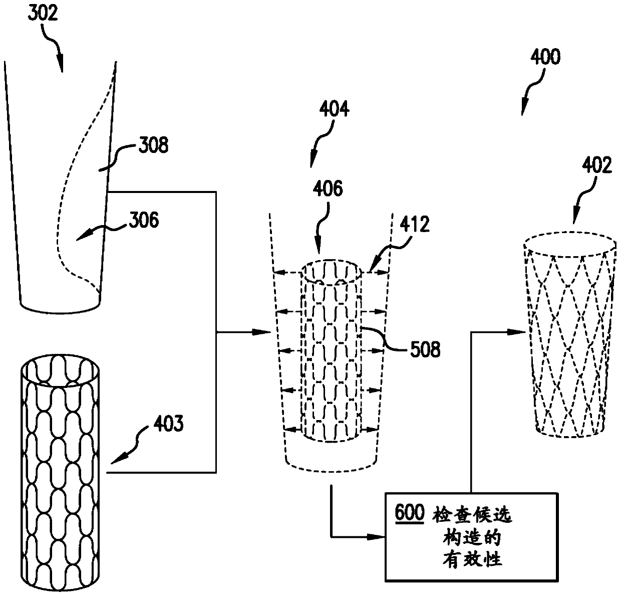 Personalized coronary stents