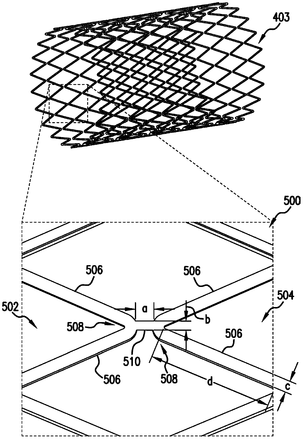 Personalized coronary stents