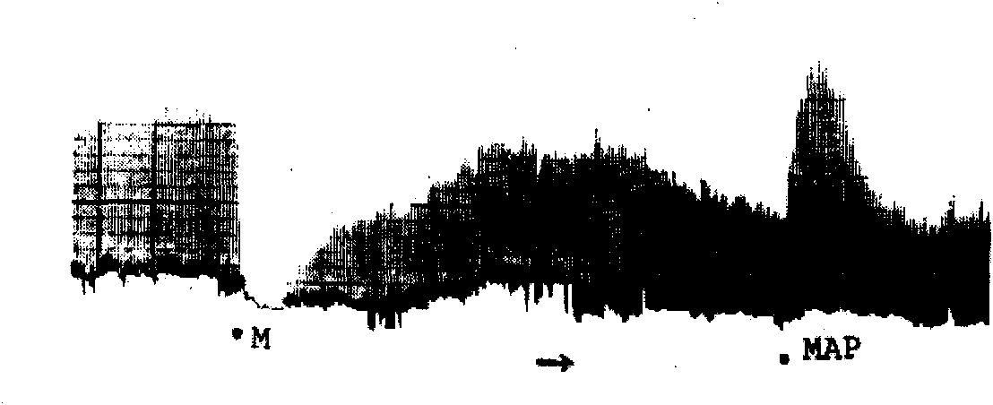 Anti-opioid peptide antagonist peptide and use thereof