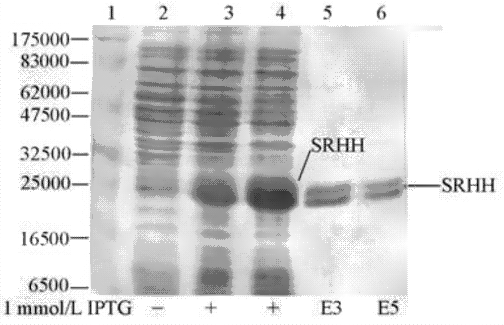 Specific inhibition compound of SAHN enzyme protein and synthetic method of specific inhibition compound