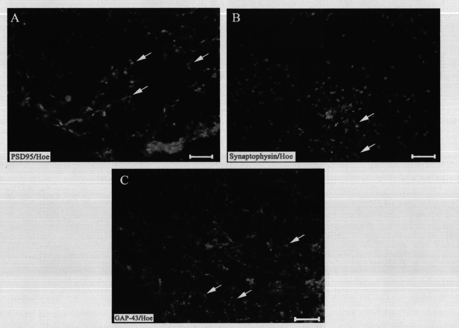 Construction of artificial neural network sample catheter for repairing spinal cord injury