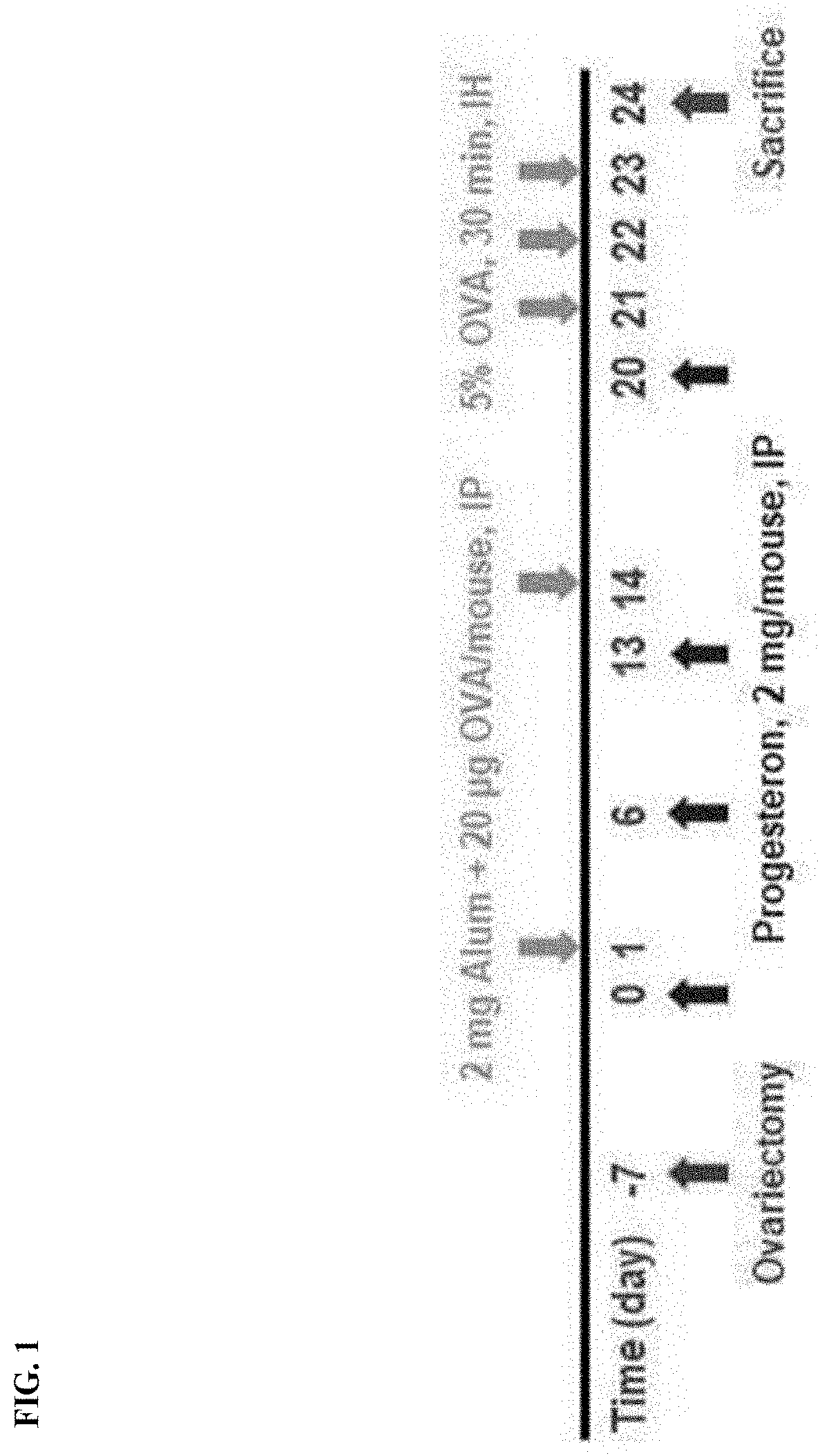 Pharmaceutical composition comprising pibf protein as active ingredient for prevention or treatment of inflammatory disease