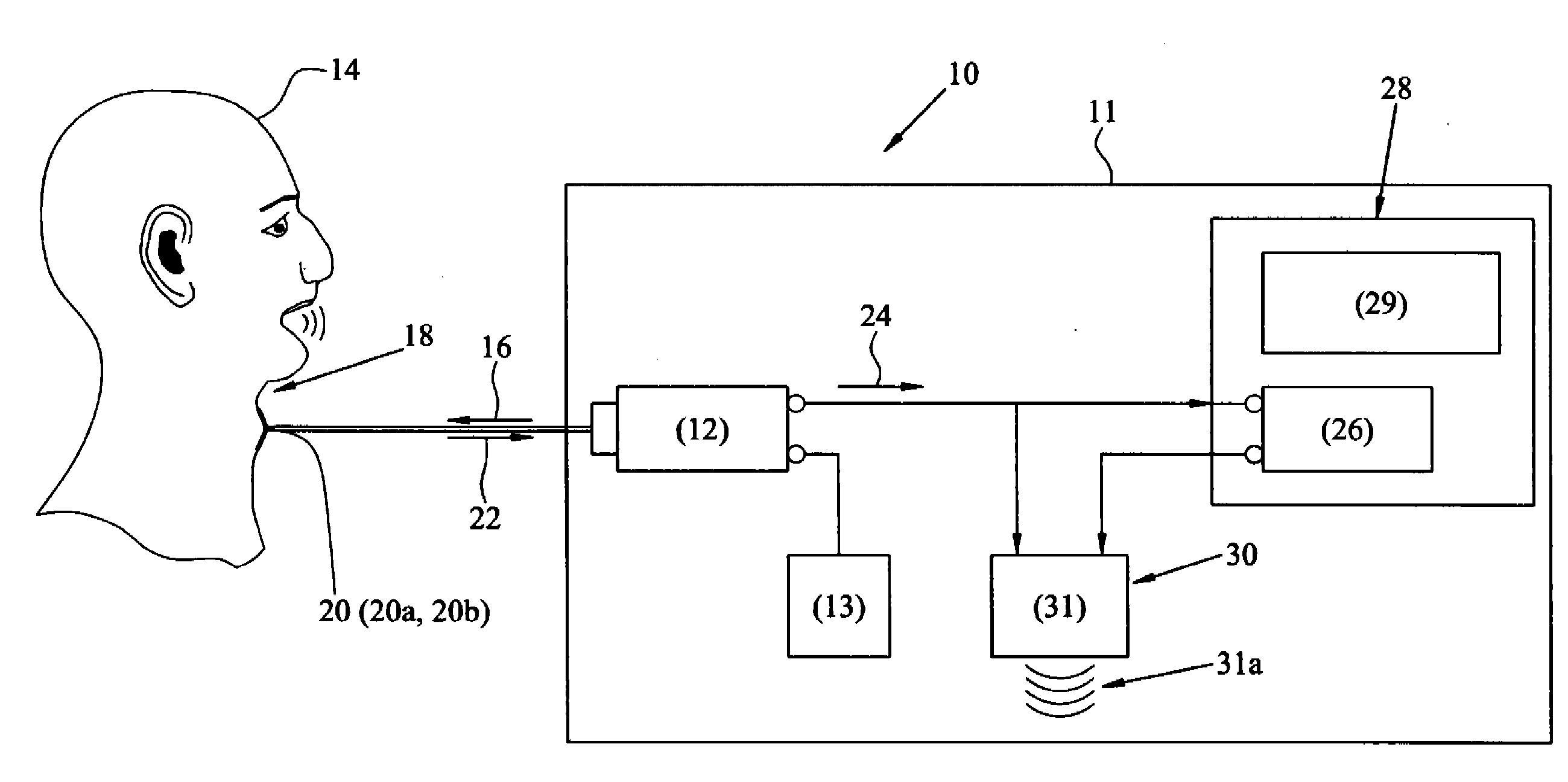 Remote Voice Detection System