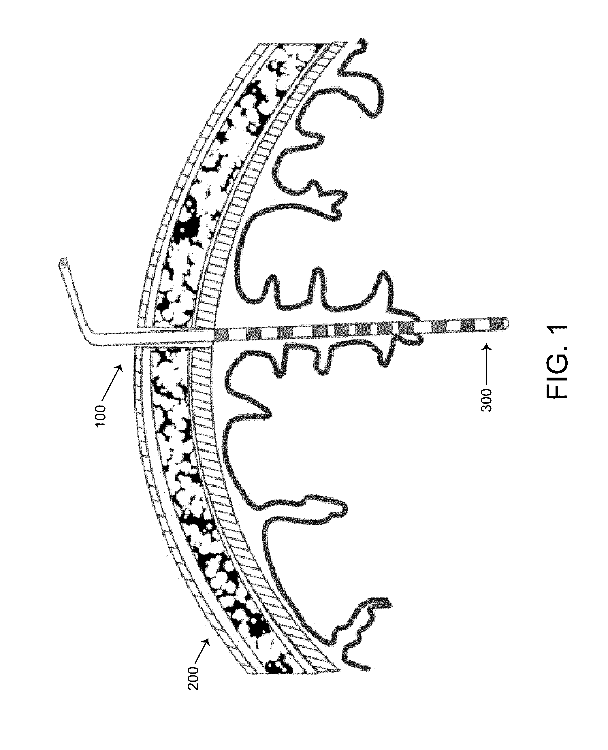 Method, system and apparatus for remote neural modulation brain stimulation and feedback control