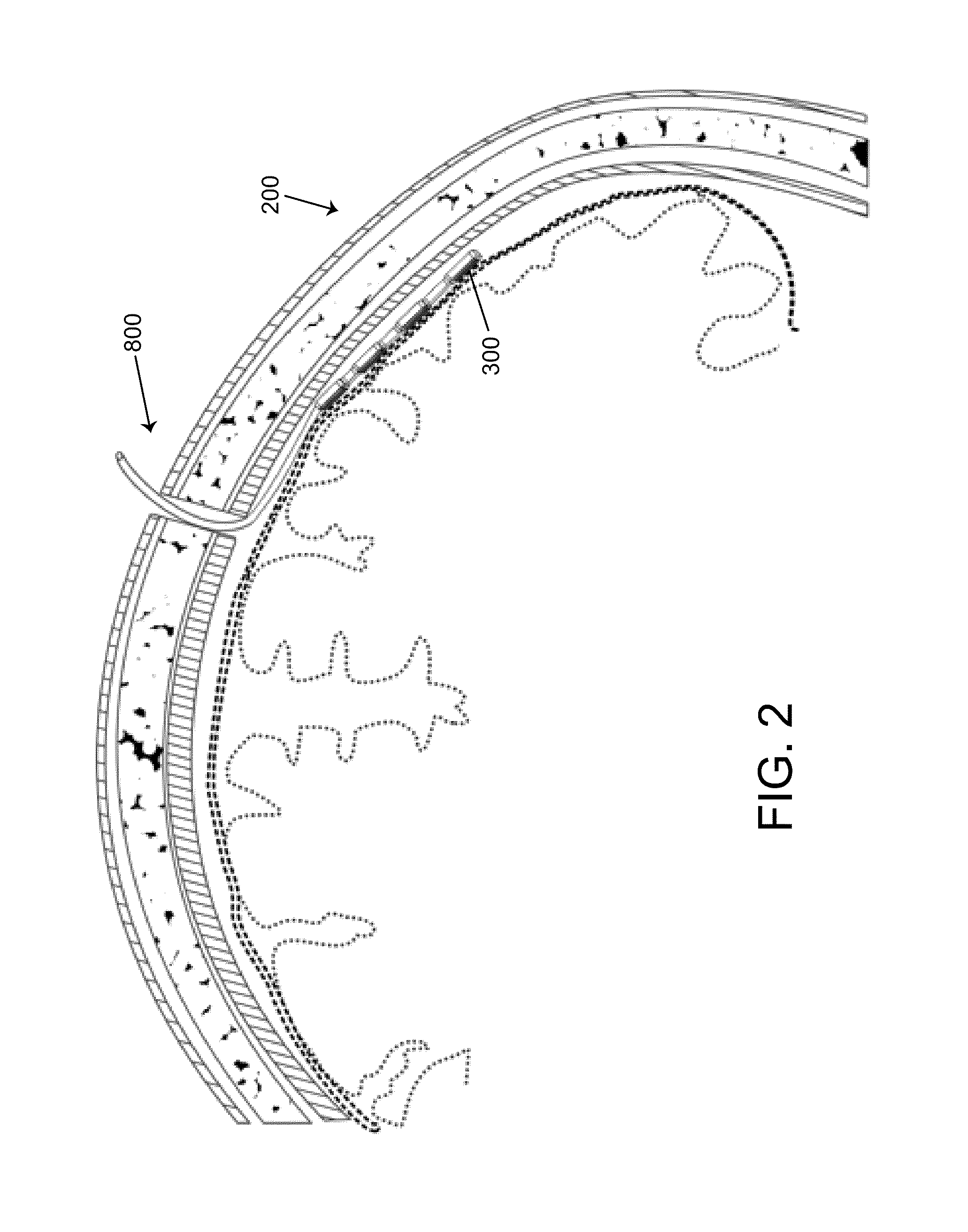 Method, system and apparatus for remote neural modulation brain stimulation and feedback control